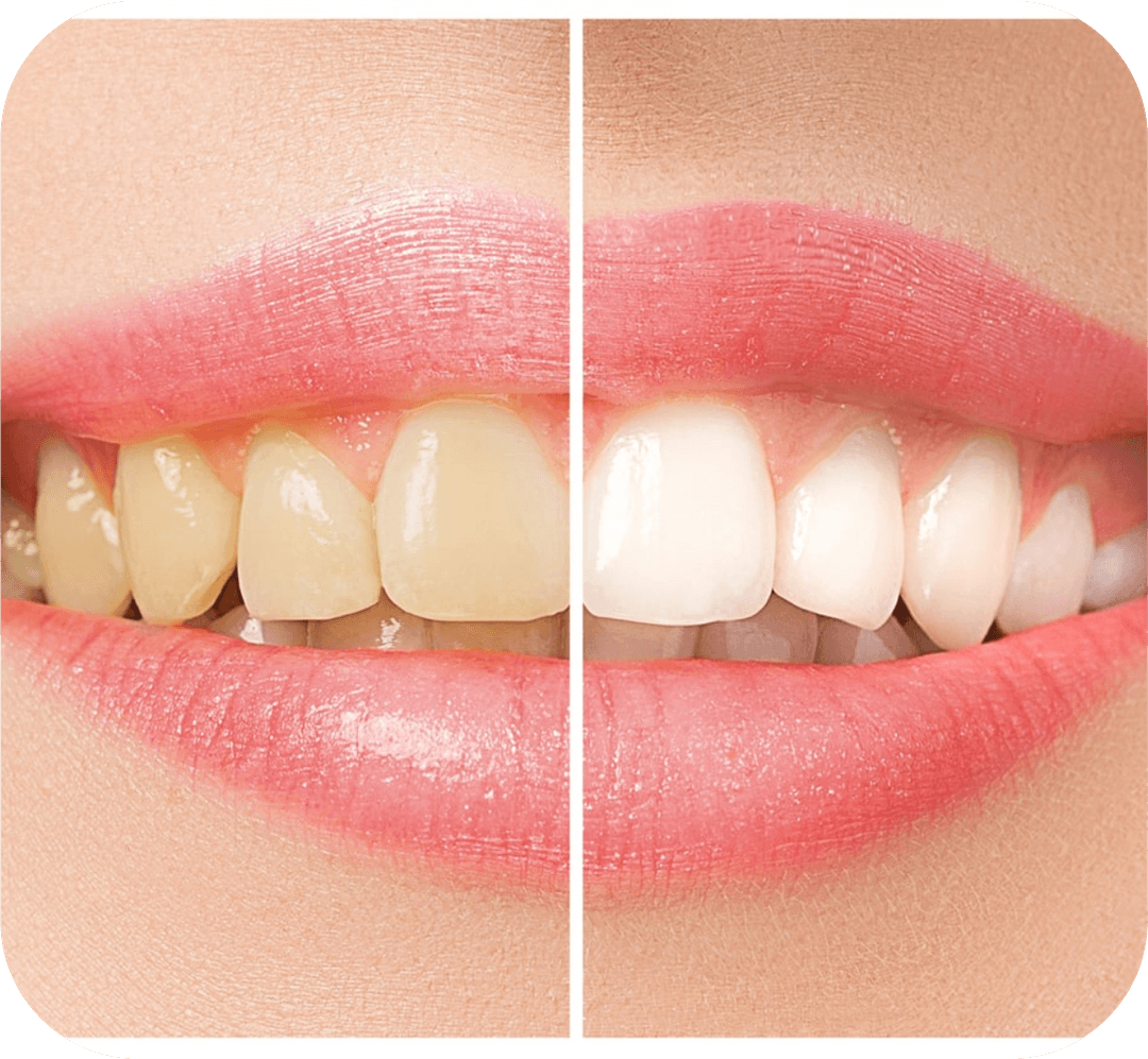 Cosmetic Dentistry