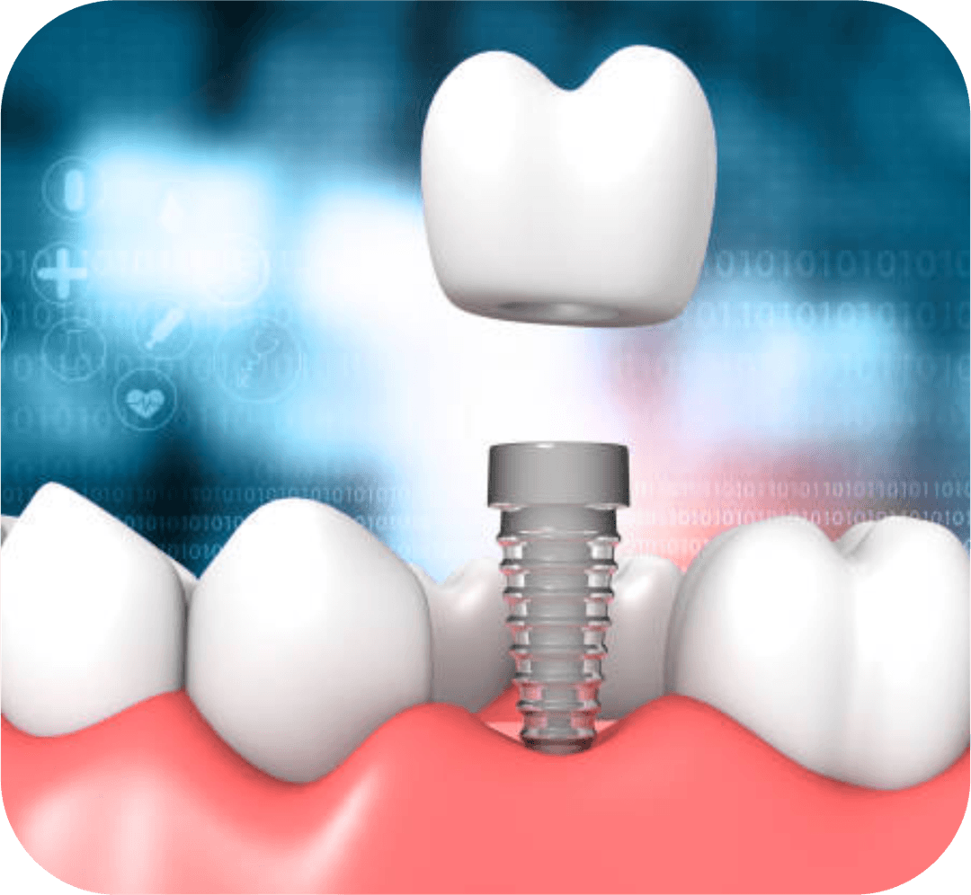 Implantology