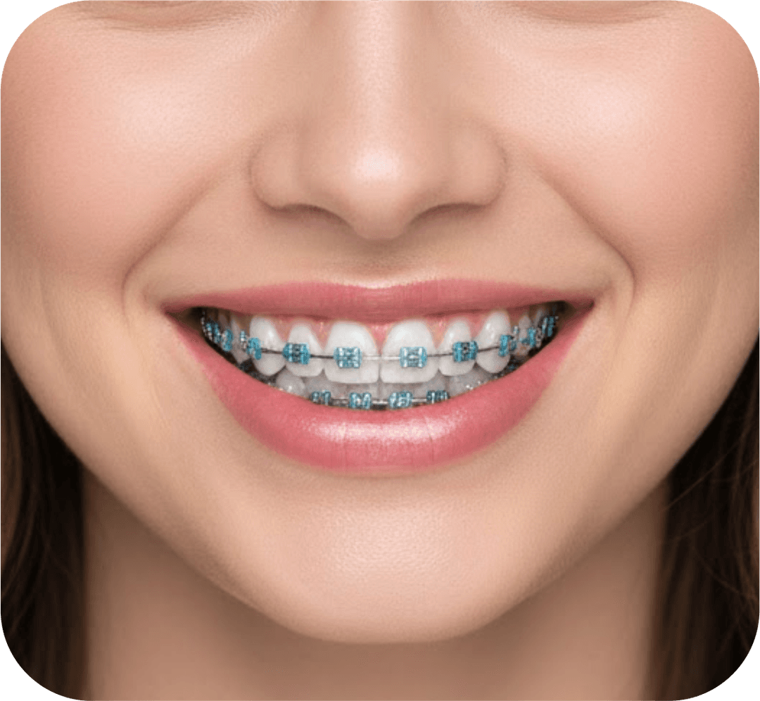 Orthodontics