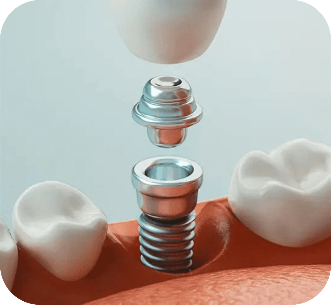 Prosthodontics