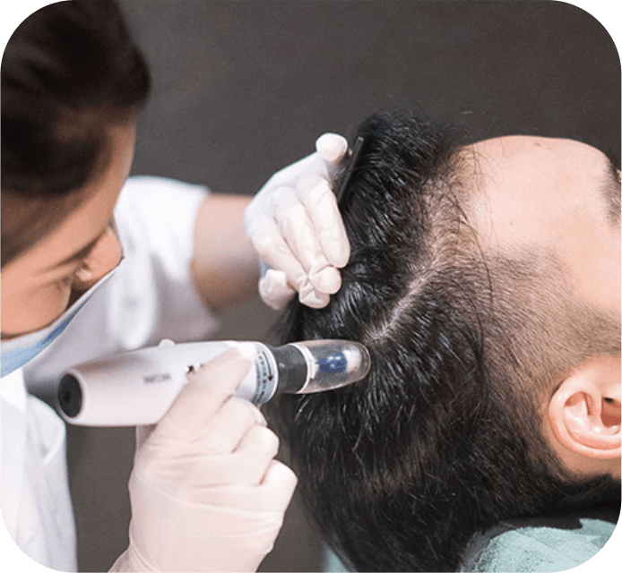 Mesotherapy Hair